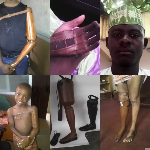 Question!! Is These prosthetics are made in Nigeria [See photos]